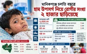 মানিকগঞ্জে চলতি বছরে হাম উপসর্গ নিয়ে রোগীর সংখ্যা ২ হাজার ছাড়িয়েছে